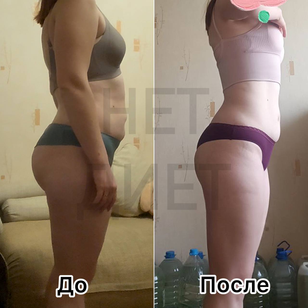 Результат Алины, 23 года, до и после прохождения курса