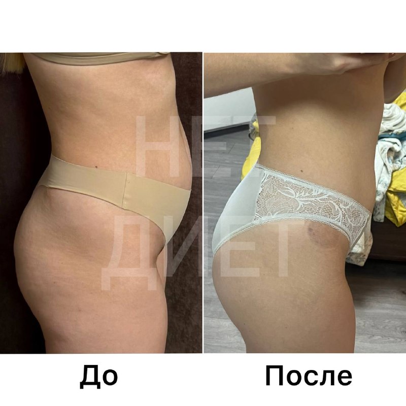Изменение объёмов Марии до и после прохождения курса